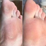 INNOXA Coupe Cors 10 Lames. paraplume